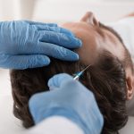 Man getting PRP hair restoration treatment